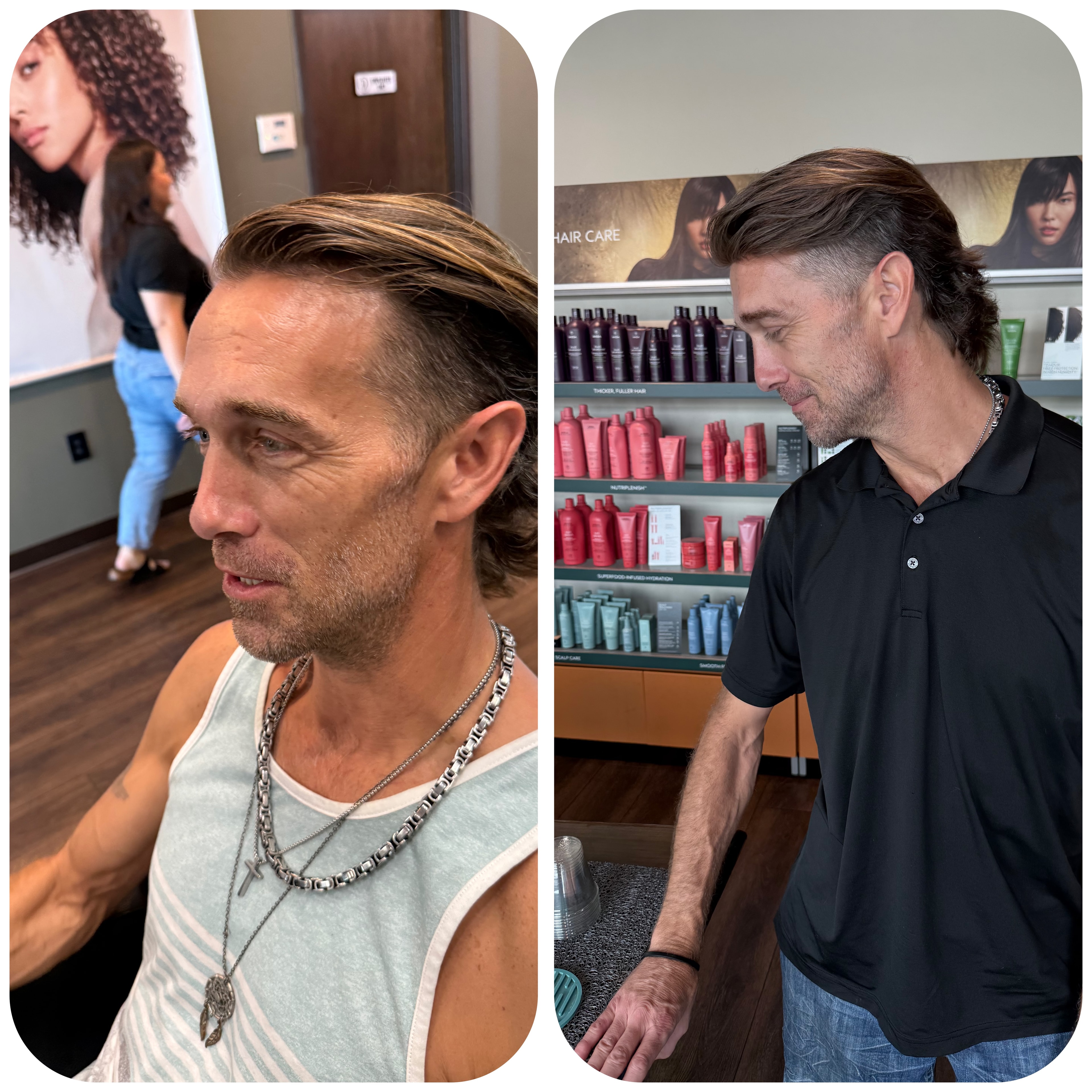 Before & after — Hairskeen (frontskeen) Men’s Hair System