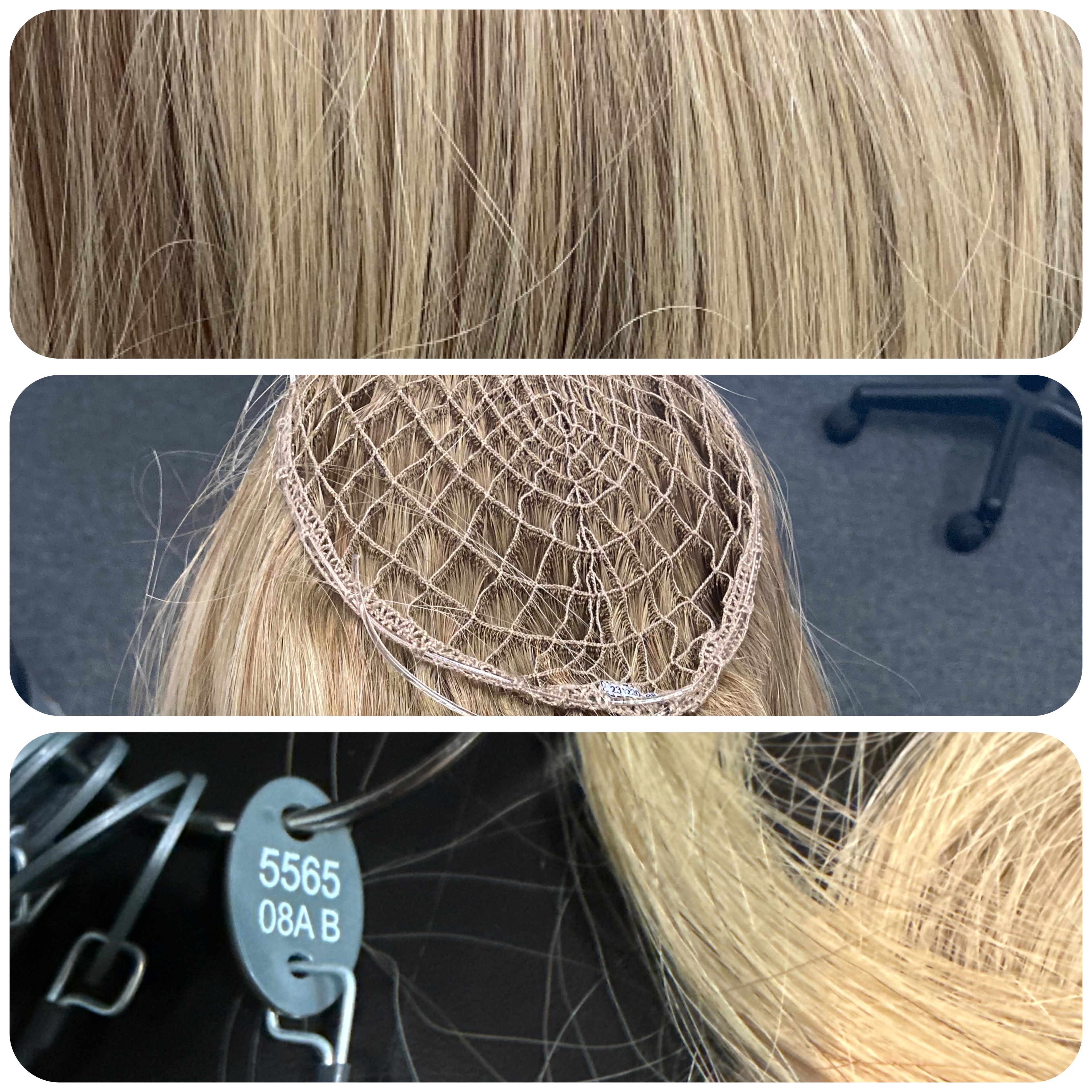 Woman with restored hair confidence